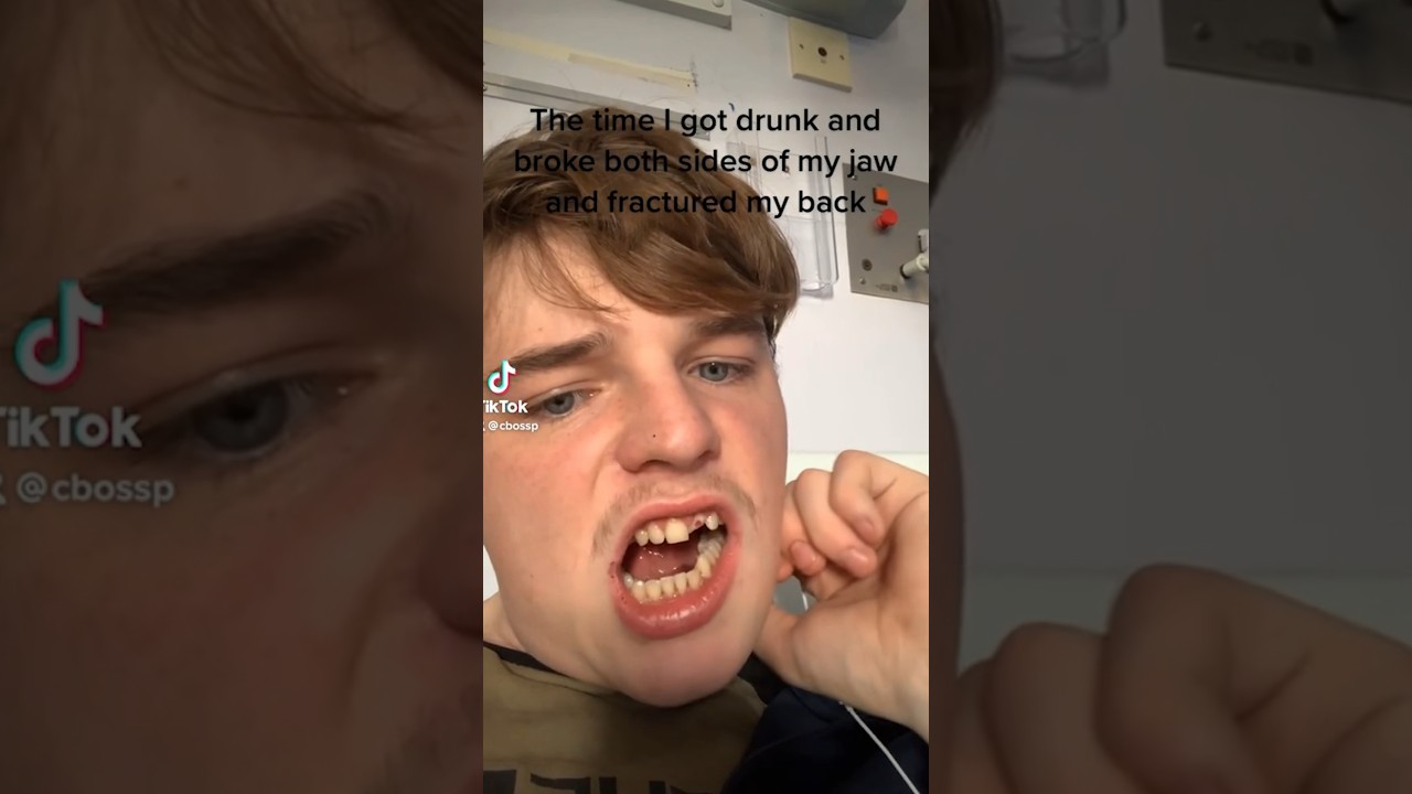 He Broke His Jaw, Now It Wiggles?!