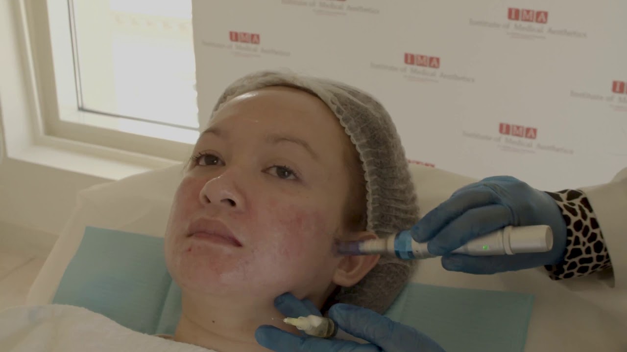 COMPLETE MESOTHERAPY TRAINING PACKAGE