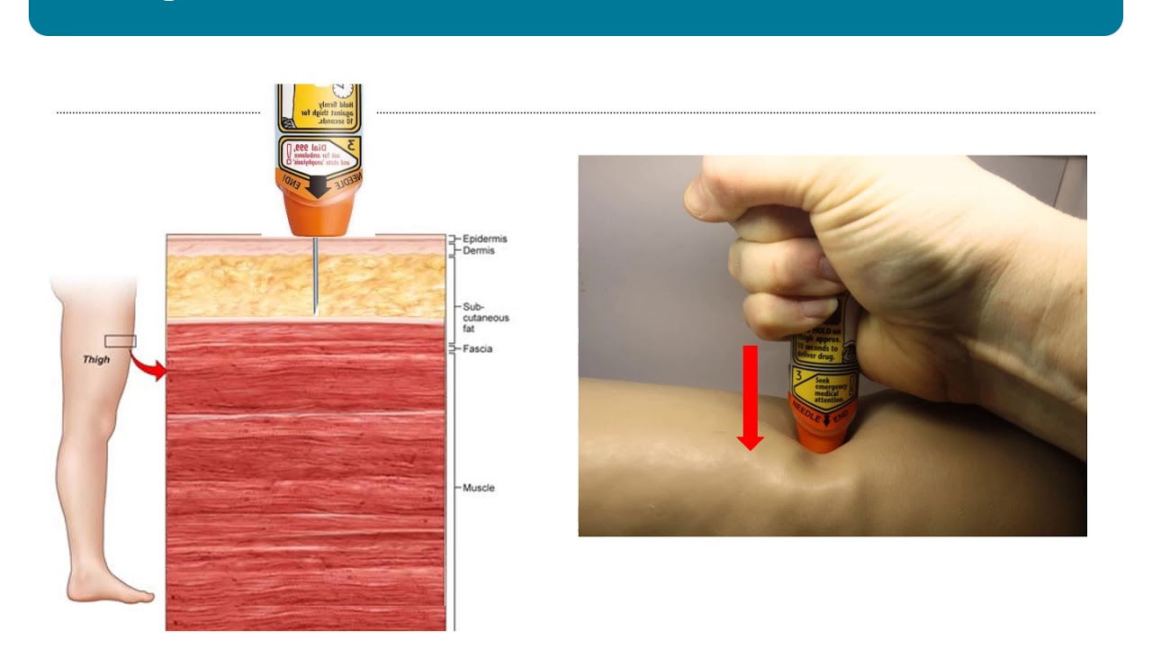 Auto-injector Needle Length and Dose