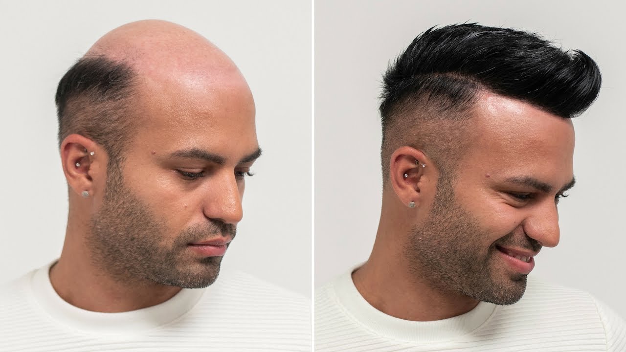 Short Hair With Non Surgical Hair Replacement | Transformation mit Haarsystem | Hairsystems Heydecke