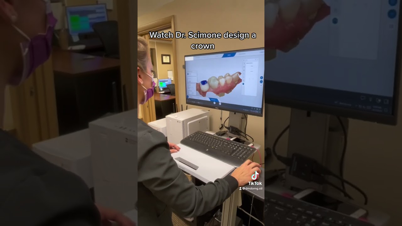 Dentist Designing a Dental Crown #design #dentalvisit #dentaleducation #dentalcrowns #crowns #cerec