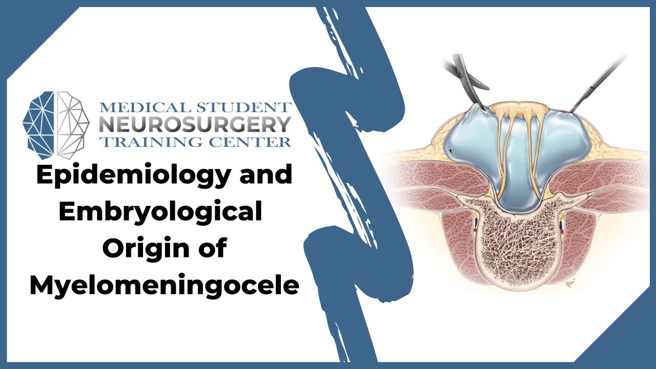 Epidemiology and Embryological Origin of Myelomeningocele
