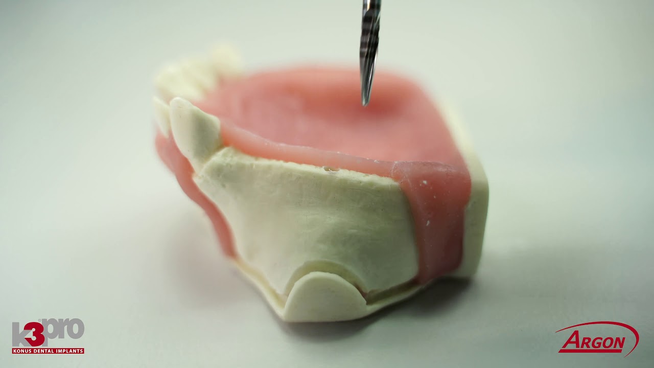 K3Pro Howto 001 - Ablauf der Implantation