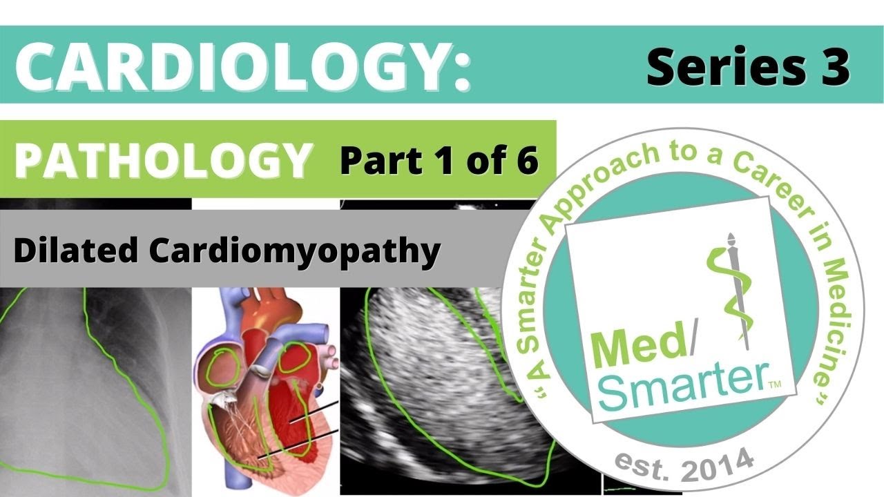 USMLE Step 1 | Cardiac: Pathology | MedSmarter | S3 Part 1 of 6 | Dilated Cardiomyopathy