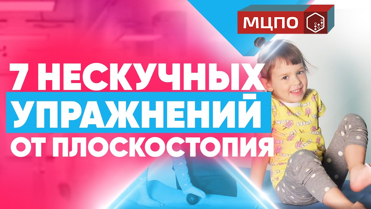 Упражнения при плоскостопии. Комплекс ЛФК