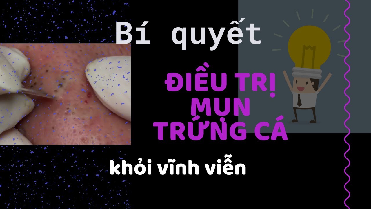 4 Bí quyết nếu MUỐN điều trị mụn không tái phát -  - Dr Hiếu Aesthetic