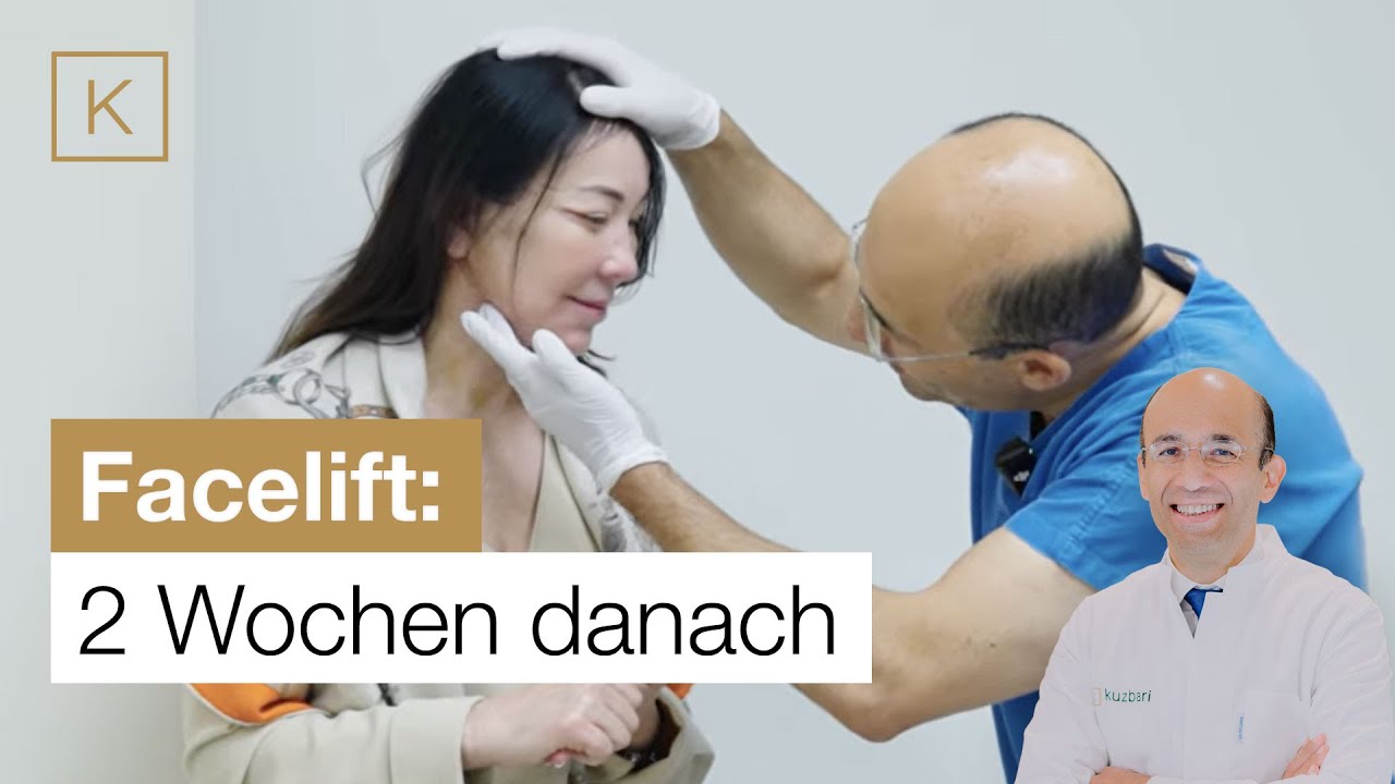 Facelift-Heilung: Was passiert in Woche 2? (Patientenbericht)