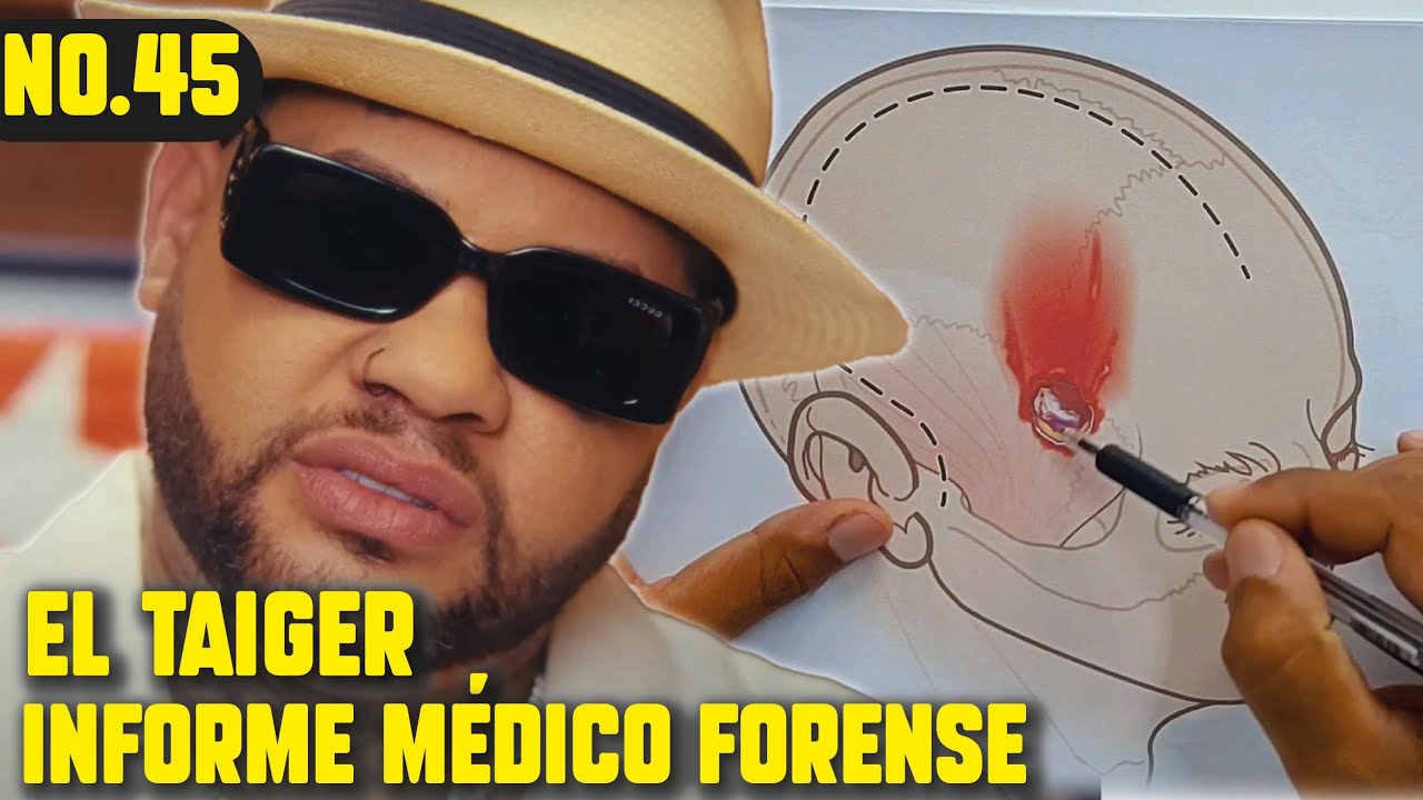 ¿Qué le pasó al TAIGER? ¿Qué complicaciones presentó? NEUROCIRUJANO reacciona al informe policial