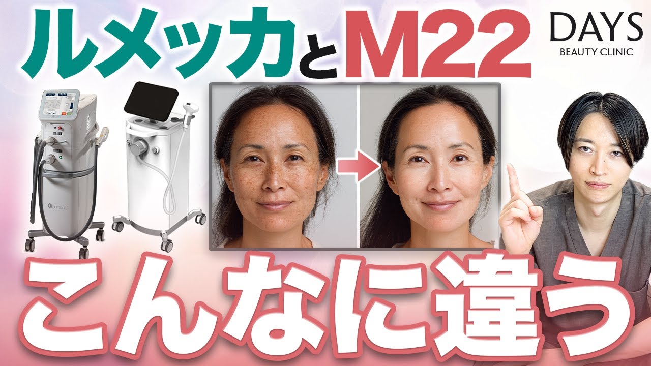 シミ・くすみを取る "ルメッカとM22" ならどっちがいいの？【IPL治療・美肌・スキンケア】