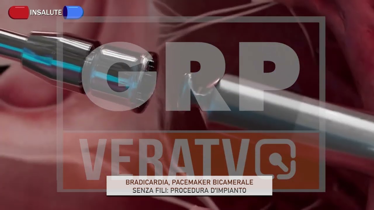 INSALUTE - BRADICARDIA E PACEMAKER - GRP VERA TV