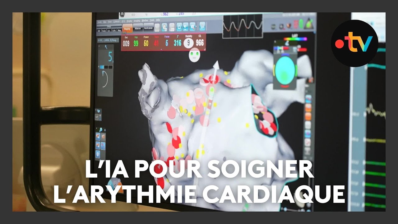 L'IA au service de la santé, de l'arythmie cardiaque en particulier