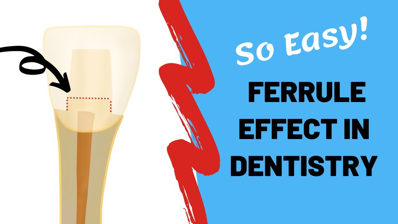 Ferrule effect in dentistry simplified | @Dr Teeth