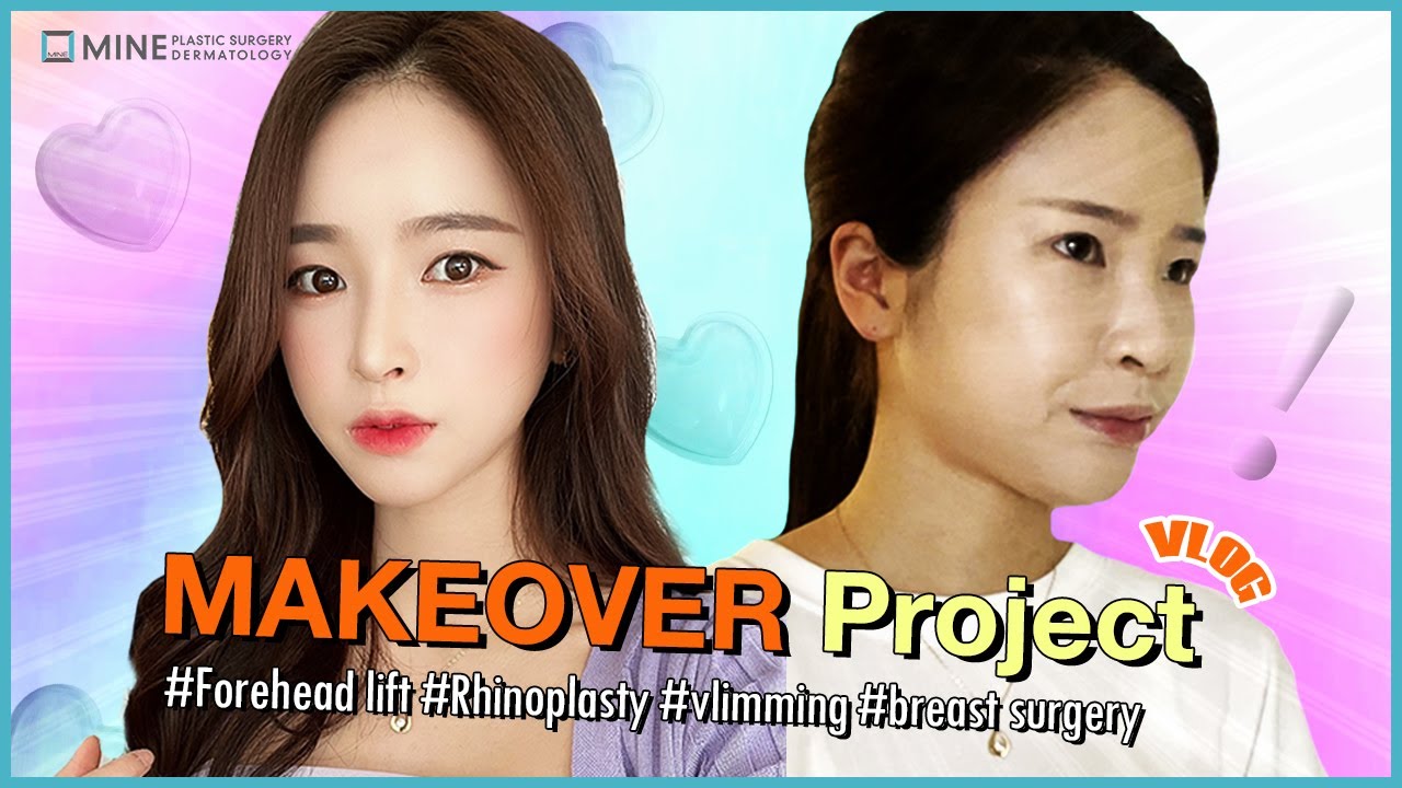 [Plastic Surgery VLOG]  Makeover Journey at Mine #foreheadlift #breastsurgery #vlimming #rhinoplasty