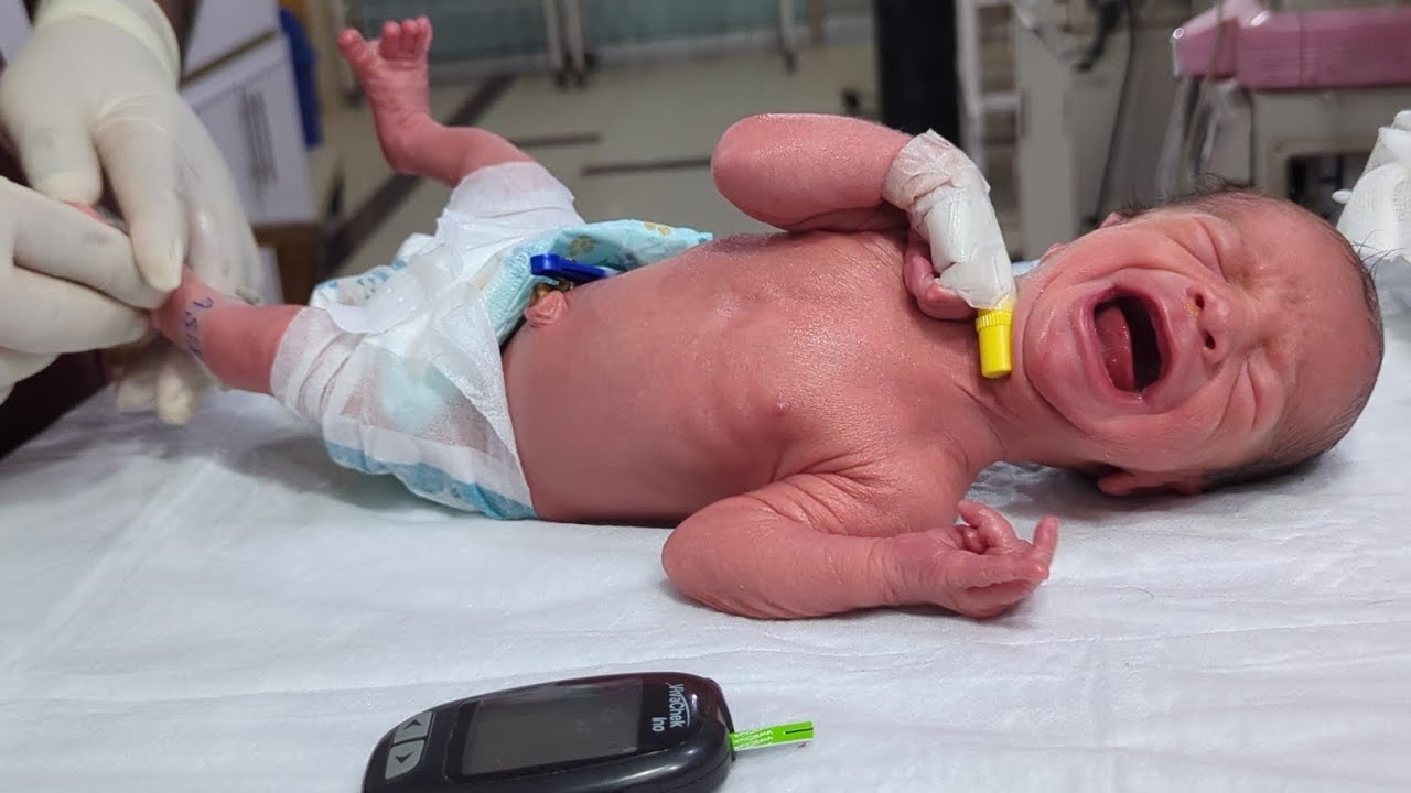 Low Blood sugar | Causes, Symptoms, Diagnosis & Treatment 🩸👶#lowbloodsugar #baby #feeding #nicubaby