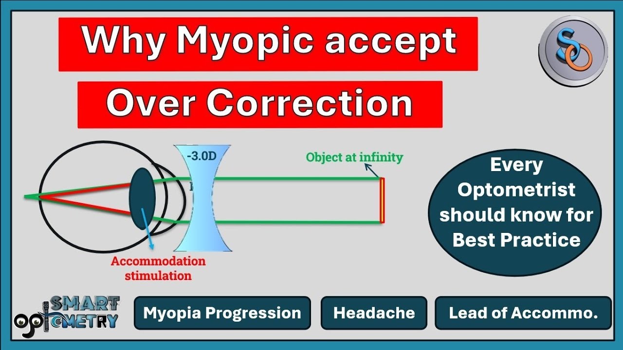 Why Myopic Patient accepts Over-correction easily during Refraction?