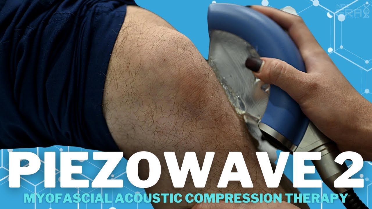PIEZOWAVE 2: INTRODUCING OUR NEW MYOFASCIAL ACOUSTIC COMPRESSION THERAPY DEVICE
