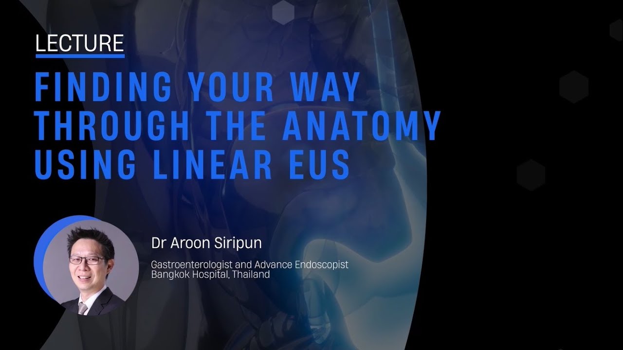 Finding your way through the Anatomy using Linear EUS (Dr. Aroon Siripun)