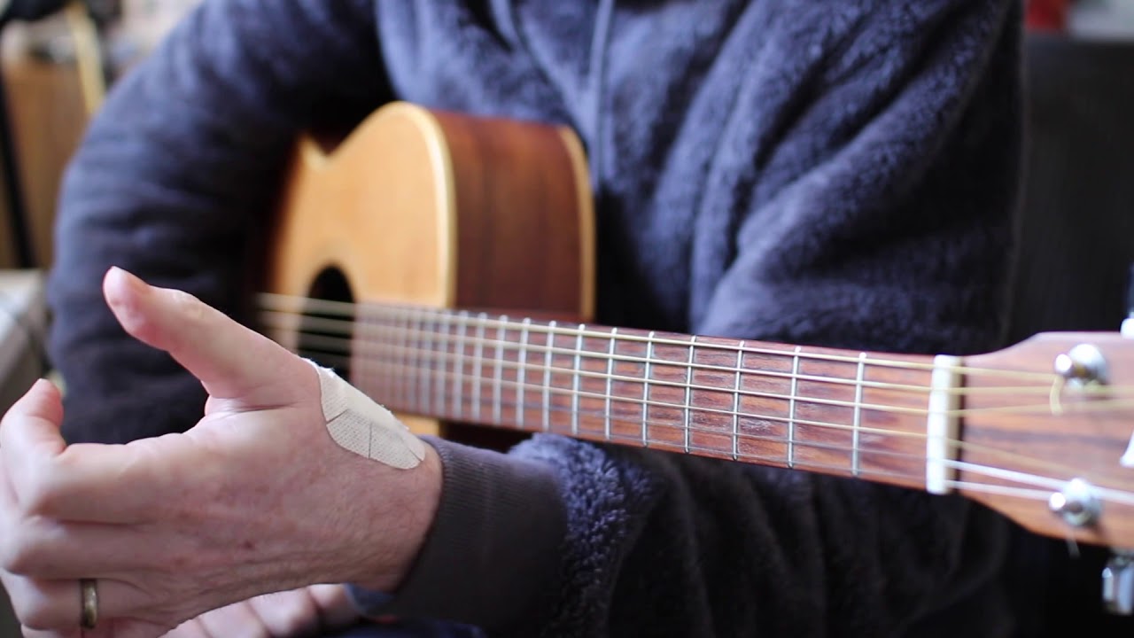 Professional musician 2 weeks after a basal thumb joint replacement