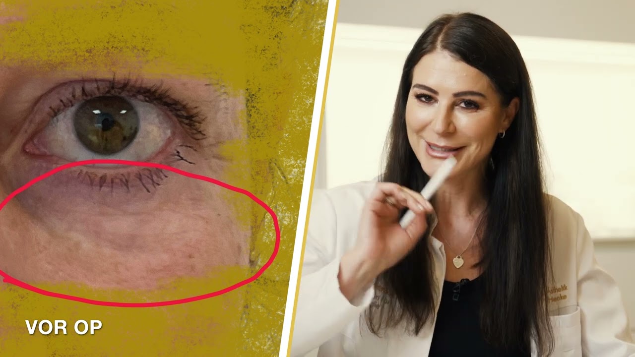 ACHTUNG:  Tränensäcke RICHTIG unterspritzen! / Fachärztin für Chirurgie Maja Henke