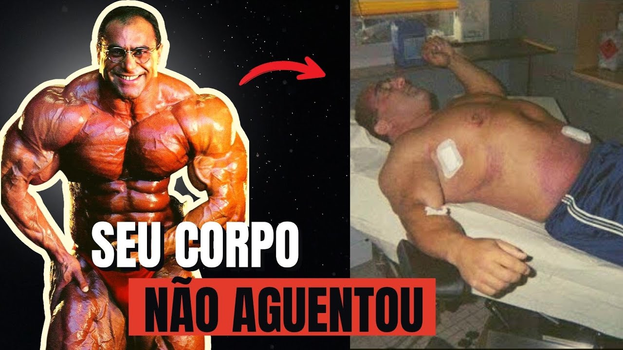 O que ACONTECEU com Nasser El Sonbaty !!!