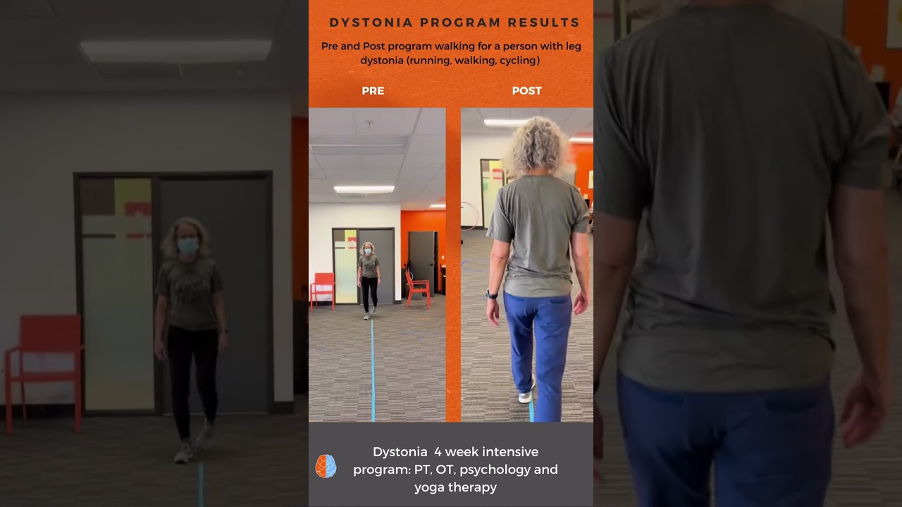 4 week dystonia intensive program outcomes