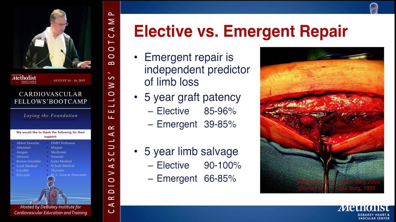 Lower Extremity Aneurysms (William T. Bohannon, MD)