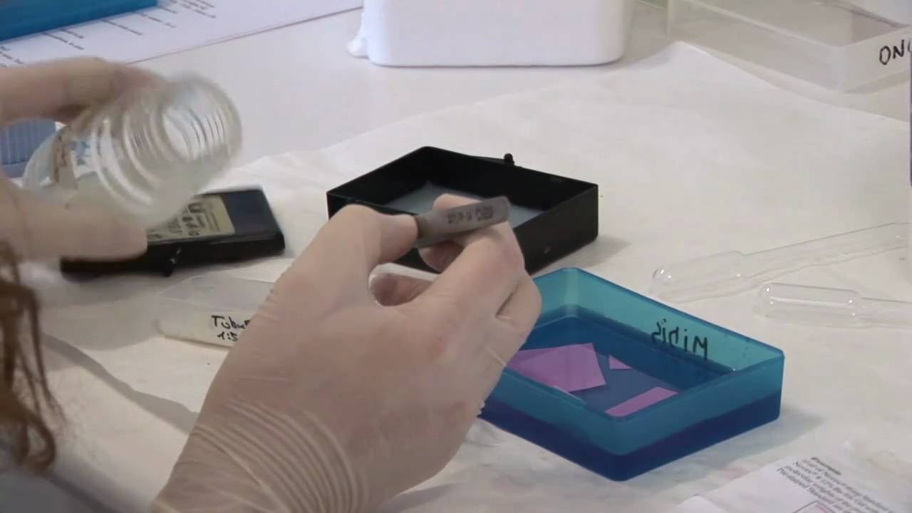 Ajuda'ns a créixer, vídeo de l'Hospital Sant Joan de Déu sobre el càncer infantil