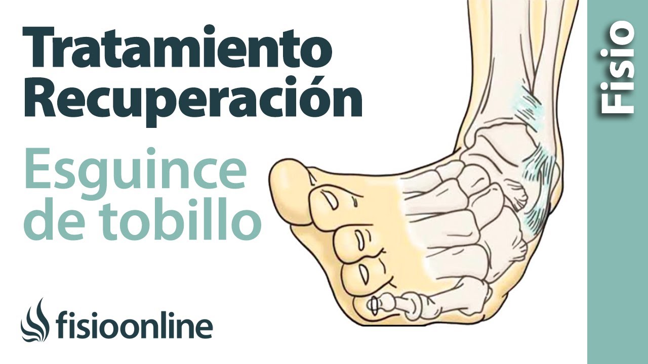 Tratamiento y recuperación de un esguince de tobillo