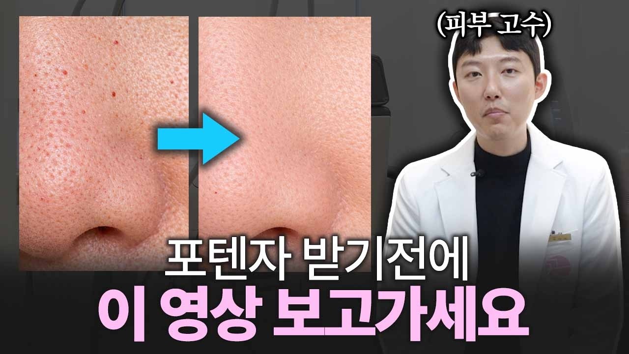 포텐자 효과 못보는 사람들의 공통점