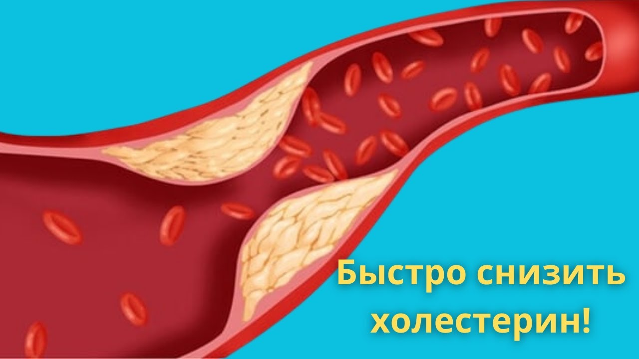 Быстро чистят сосуды и снижают вредный холестерин