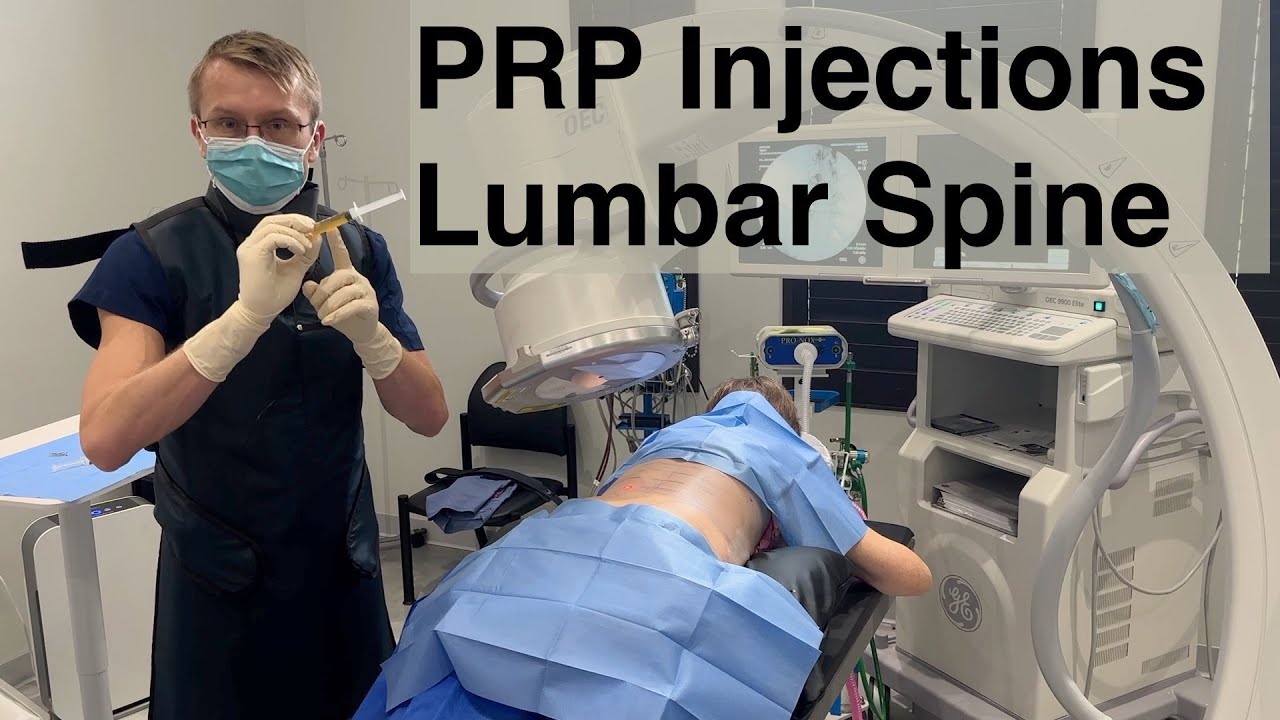 Natural Back Pain & Sciatica Treatment with PRP Injections - The Alternative to Steroids and Surgery