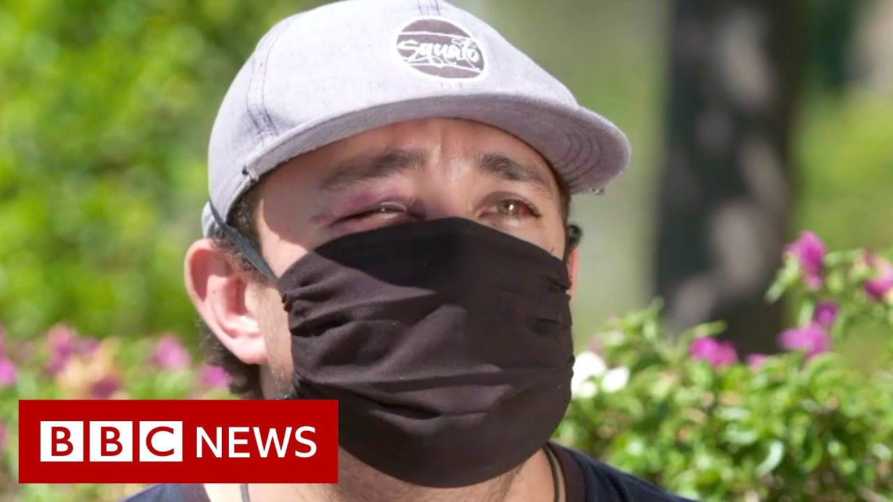 Coronavirus: Mexico healthcare workers attacked - BBC News