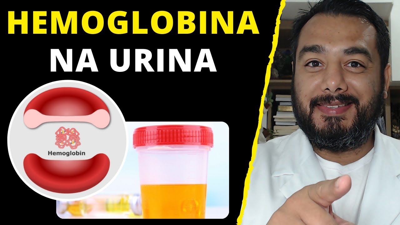 Qual o significado de hemoglobina positiva na urina (hemoglobinúria) no exame de urina tipo 1?