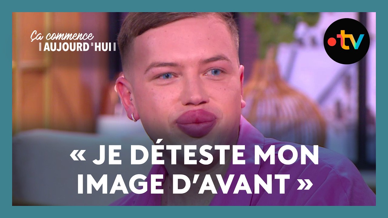 Chirurgie esthétique : dans sa quête de perfection, Yohan n'est jamais satisfait - CCA