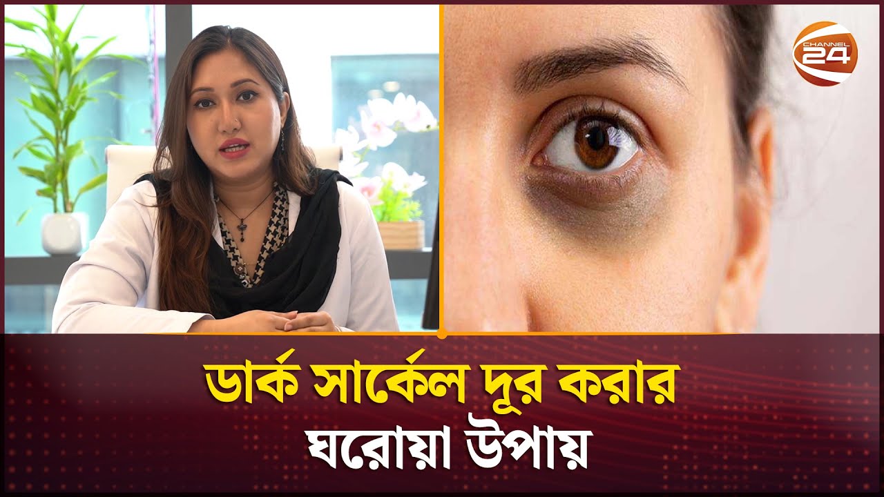 ডার্ক সার্কেল দূর করার ঘরোয়া উপায় | How to Get Rid of Dark Circles Under Eyes | Channel 24