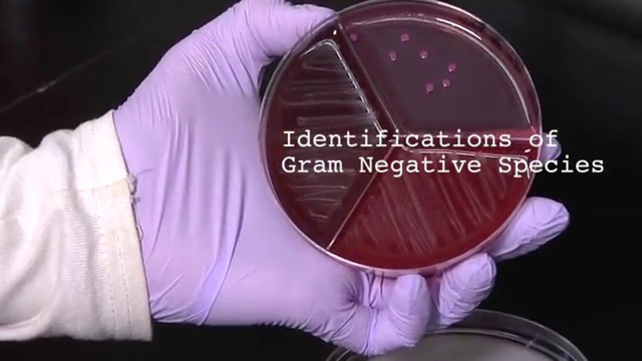 10. How to Identify Gram Negative Species