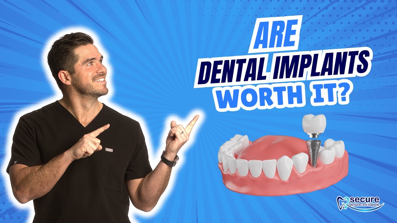 Are Dental Implants Worth It?