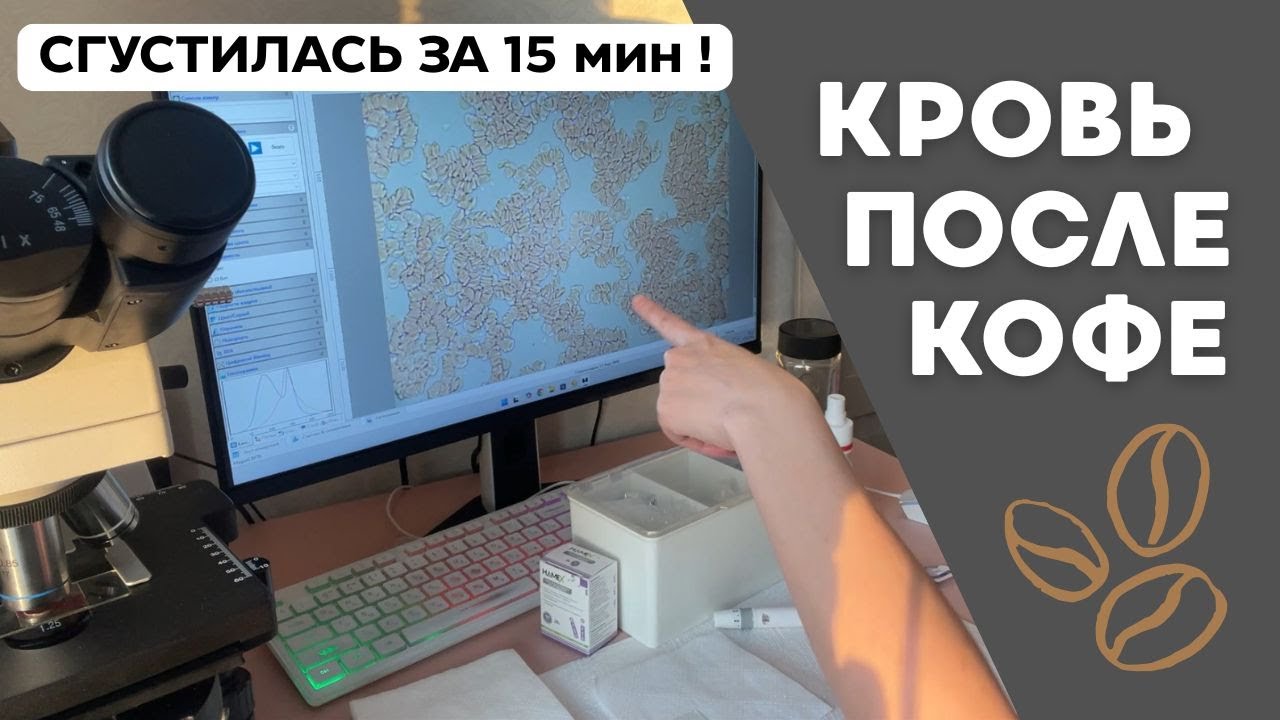 Кровь ДО и ПОСЛЕ кофе в режиме реального времени.  Результат ужасает.