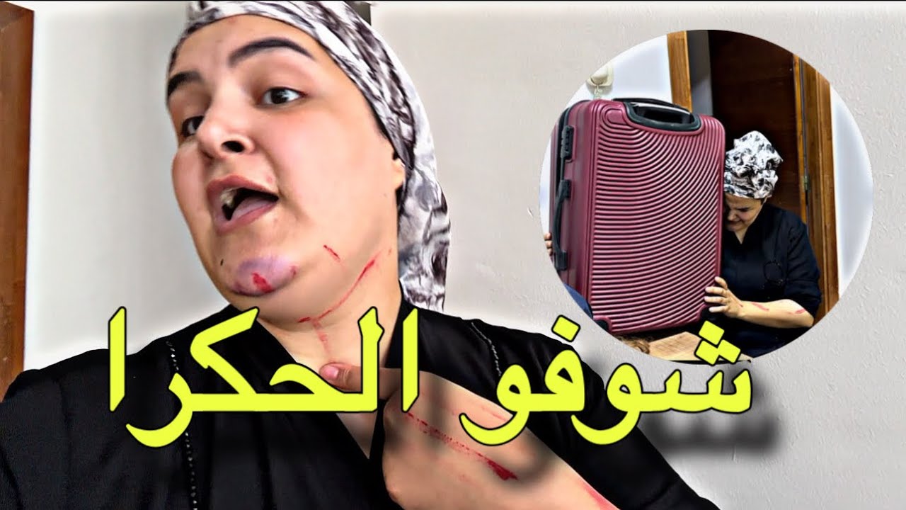 وقعات كاريثة أنمشي فحالي