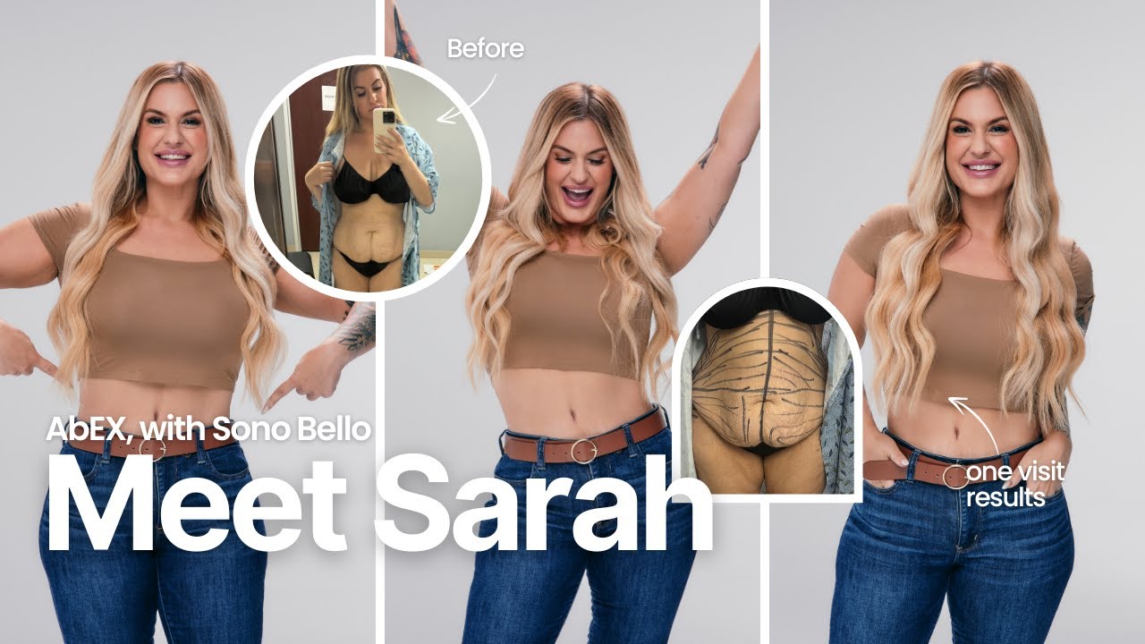 How Sono Bello Gave Sara Her Dream Body