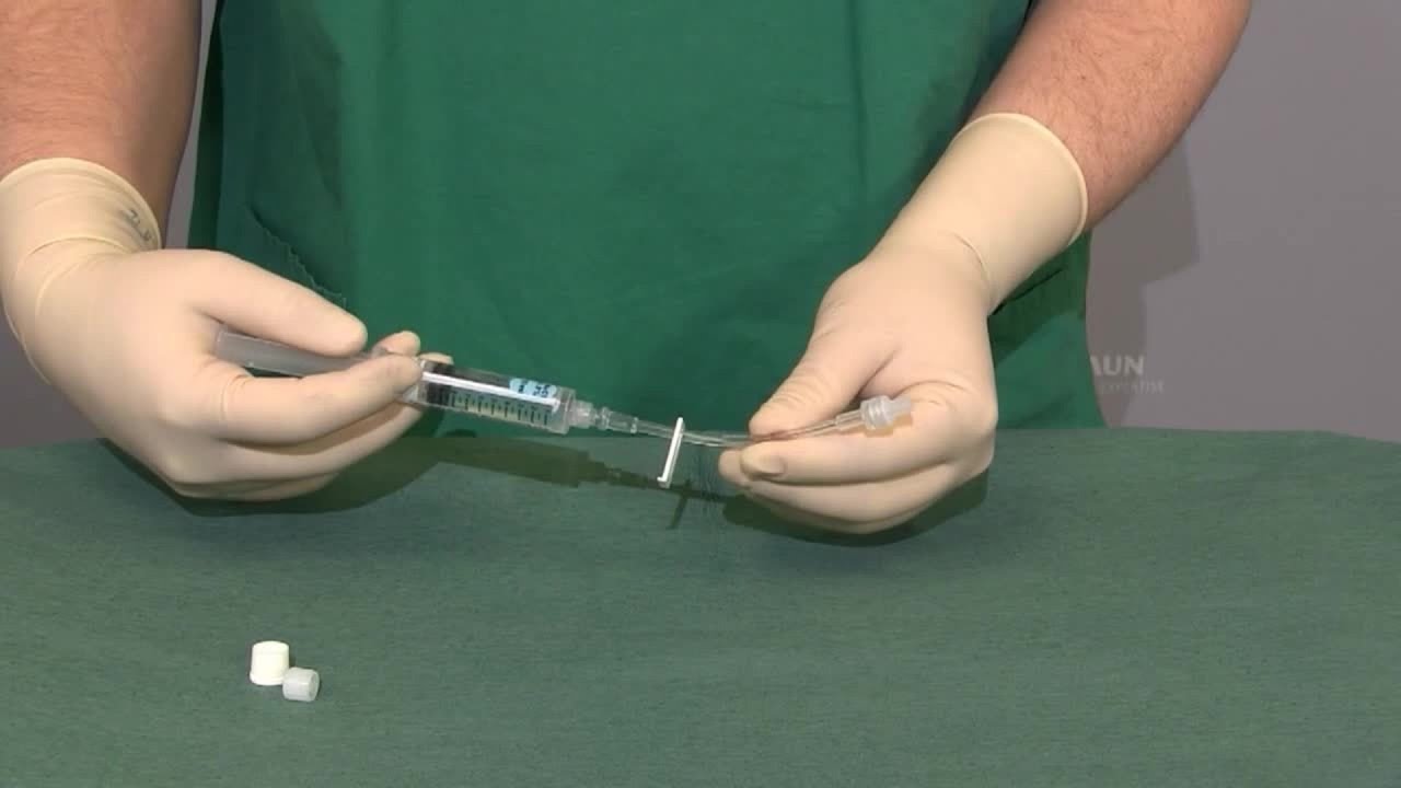 Versorgung eines ruhenden PVK mit einer Heidelberger Verlängerung und einem Combi-Stopper