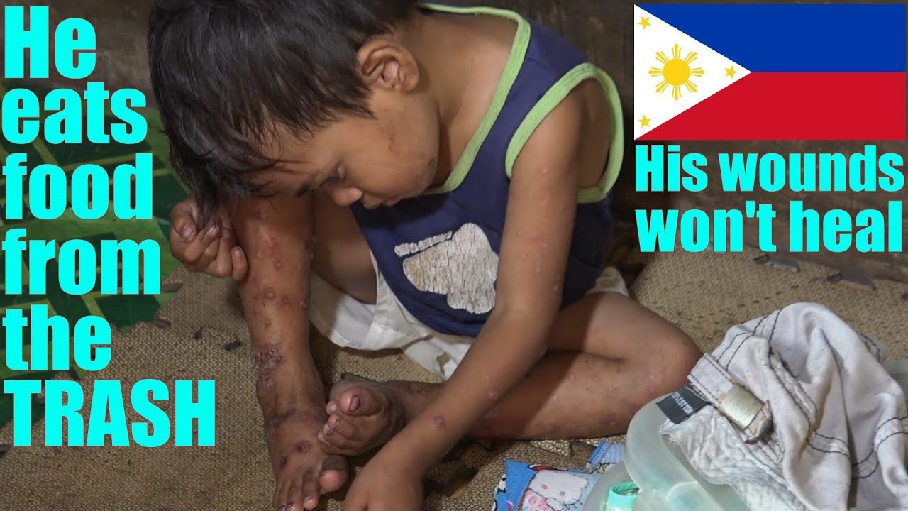 Travel to Manila Philippines and Meet This BOY Who Eats FOOD From The TRASH. A Film About Poverty