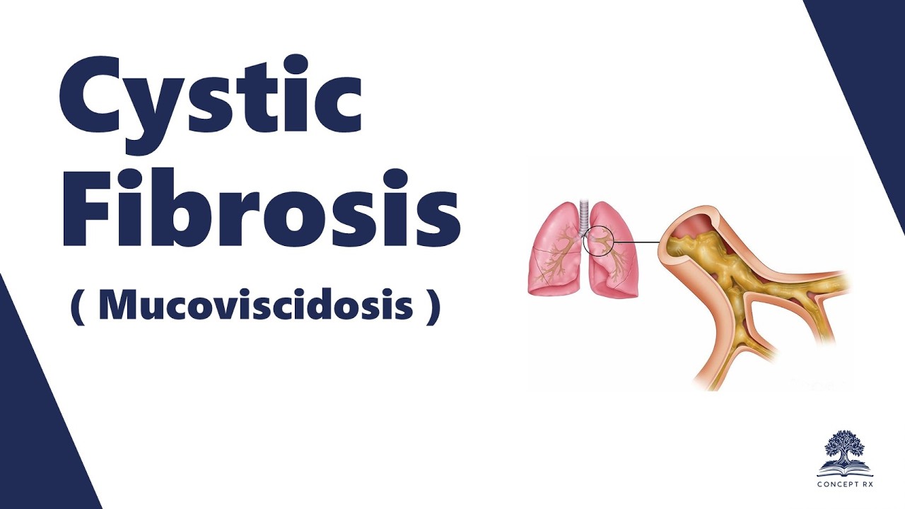 Cystic fibrosis - Definition, Etiology, Mutations, Symptoms & Treatment explained!