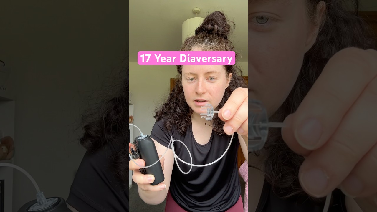 17 years of type 1 Diabetes! Ask me questions! #insulinpump #type1diabetes #typeonediabetes