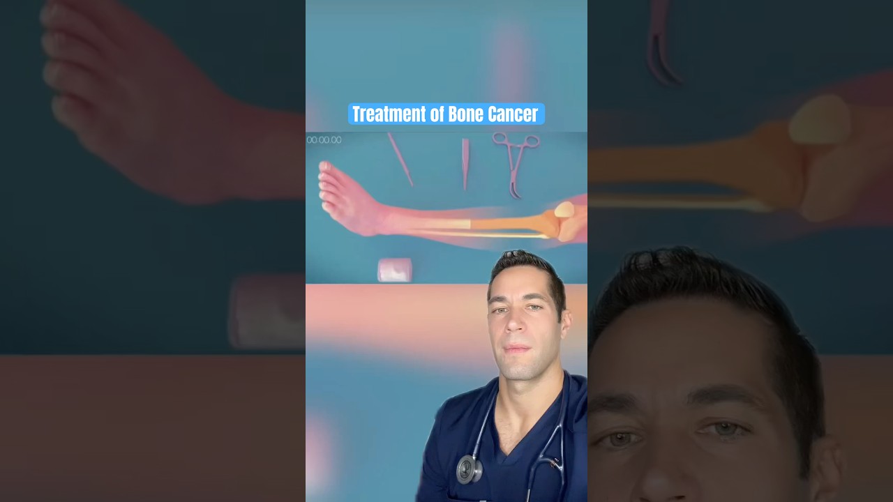 Doctor Reacts: bone cancer treatment