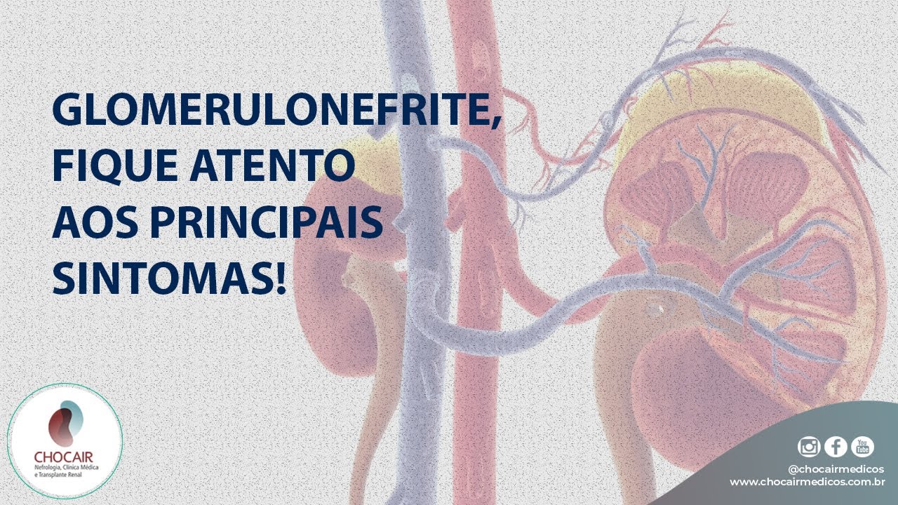 Glomerulonefrite, fique atento aos principais sintomas! | Chocair M&eacute;dicos Associados
