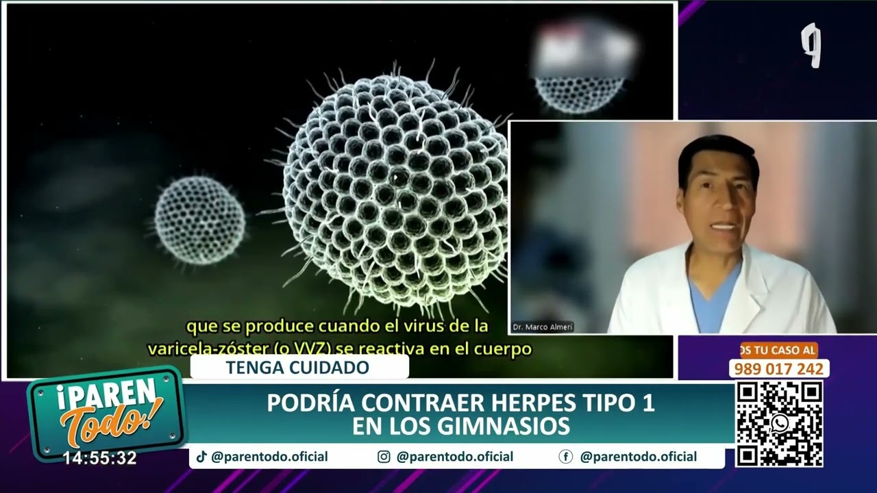 ¡Tenga cuidado!: Podría contraer herpes tipo 1 en los gimnasios