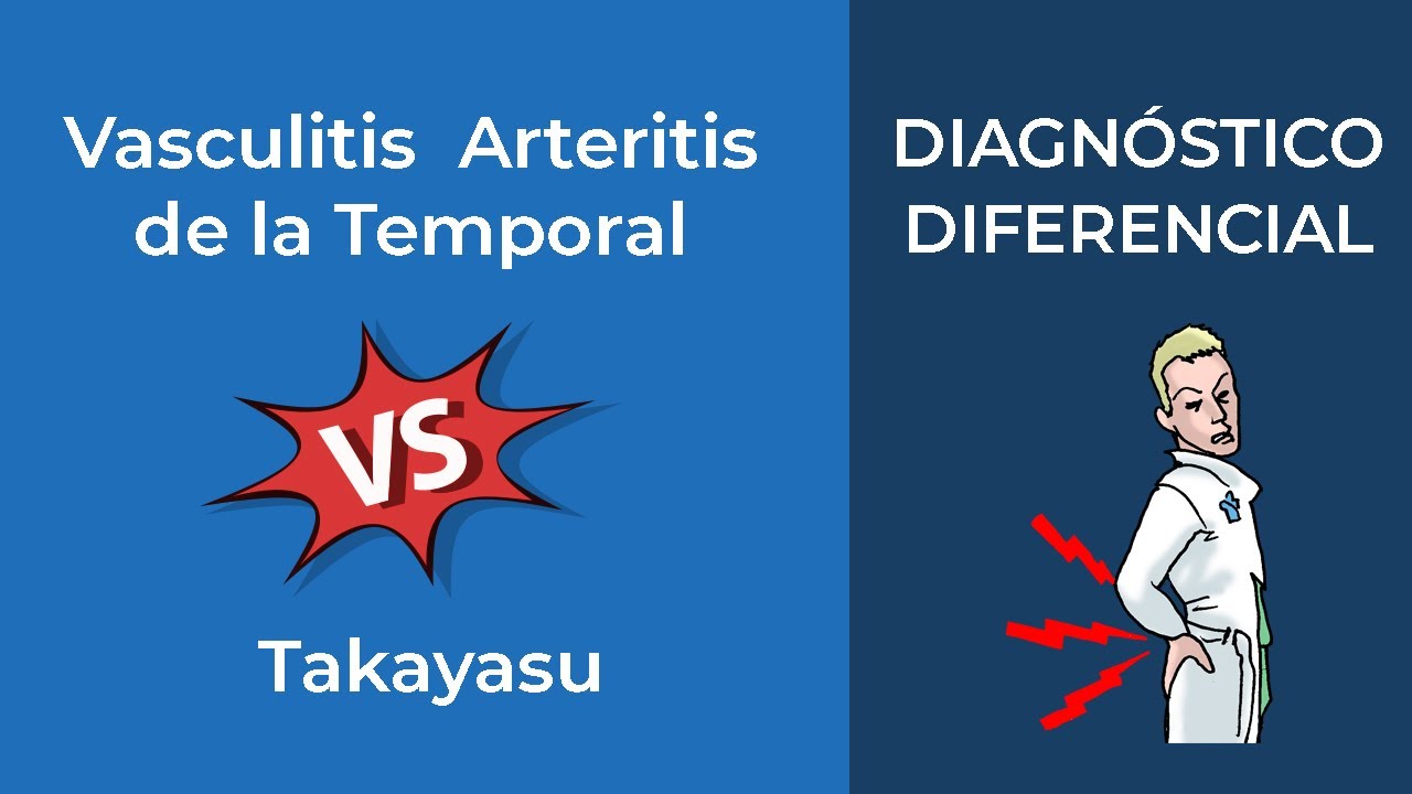 Diagnóstico Diferencial. Vasculitis  Arteritis de la Temporal vs Takayasu