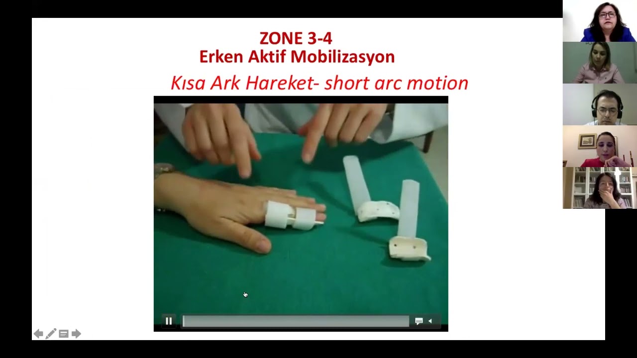 Ekstans&ouml;r tendon yaralanmalarında splint kullanımı-Uzm.Fzt.Beray Keleşoğlu Işın
