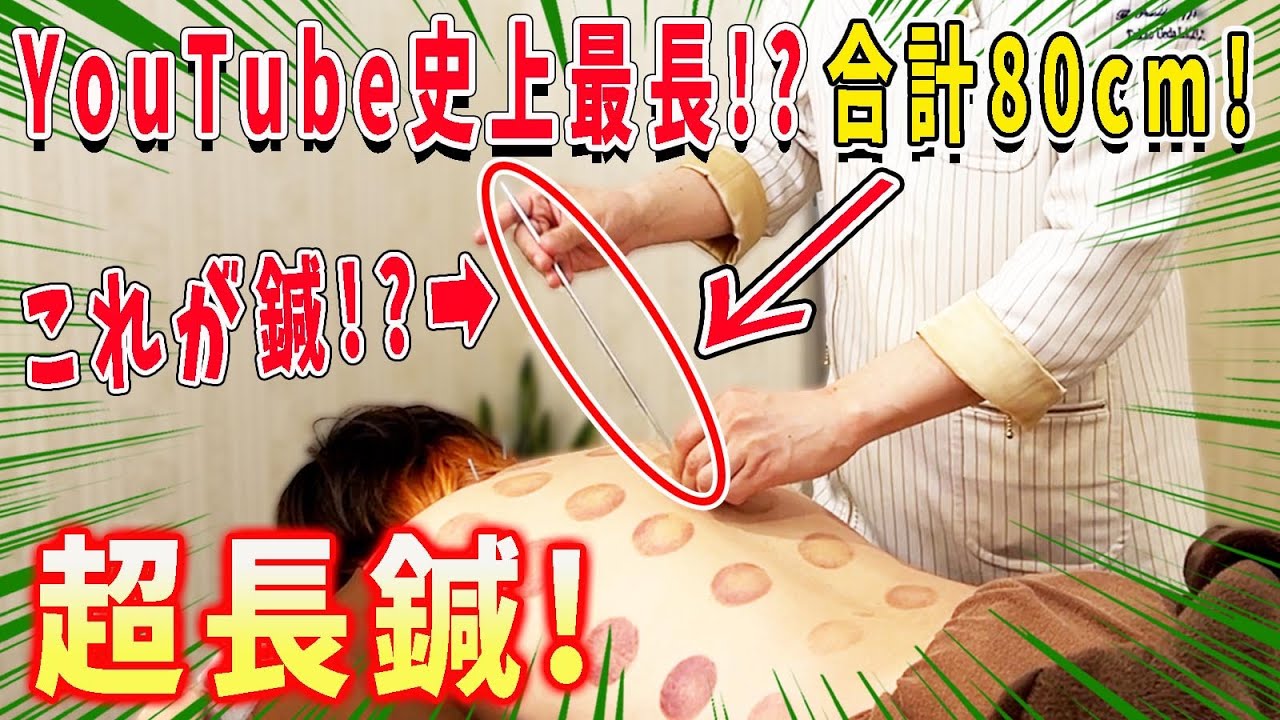【鍼治療】YouTube史上最長!?合計80cm！鍼キングの超長鍼で免疫力爆上げ！【@togohariking 】【@uwasa-no-canna 】